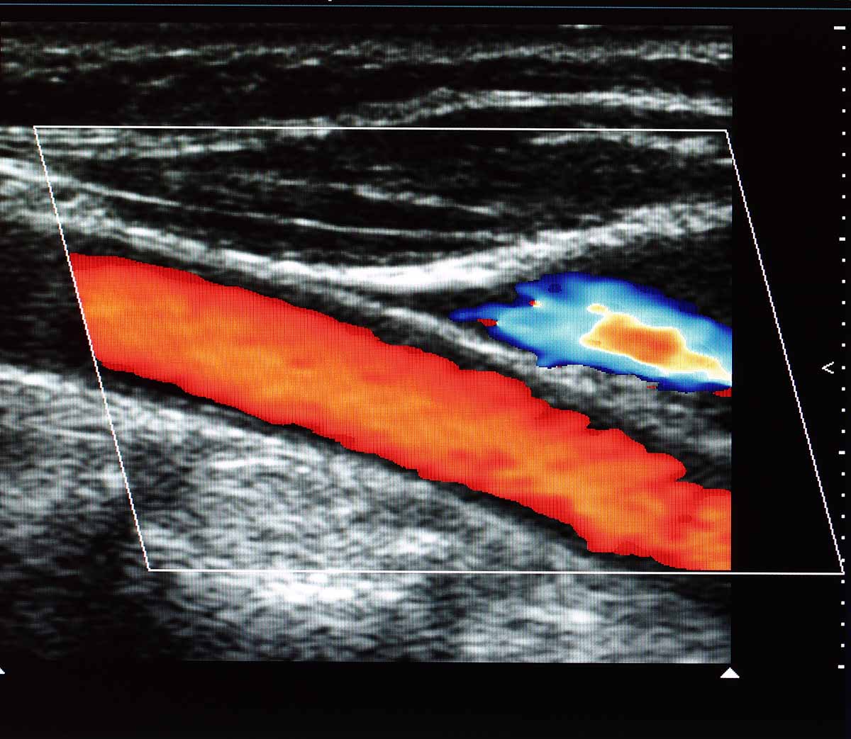 ecocolordoppler.jpg